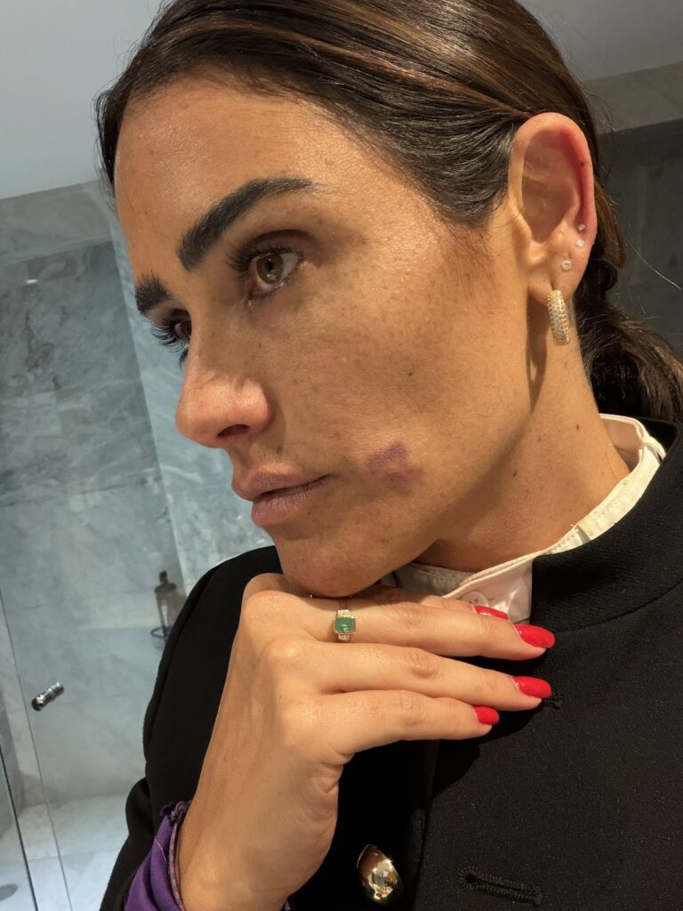 Alessandra Rojo denuncia agresión en operativo en Zona Rosa